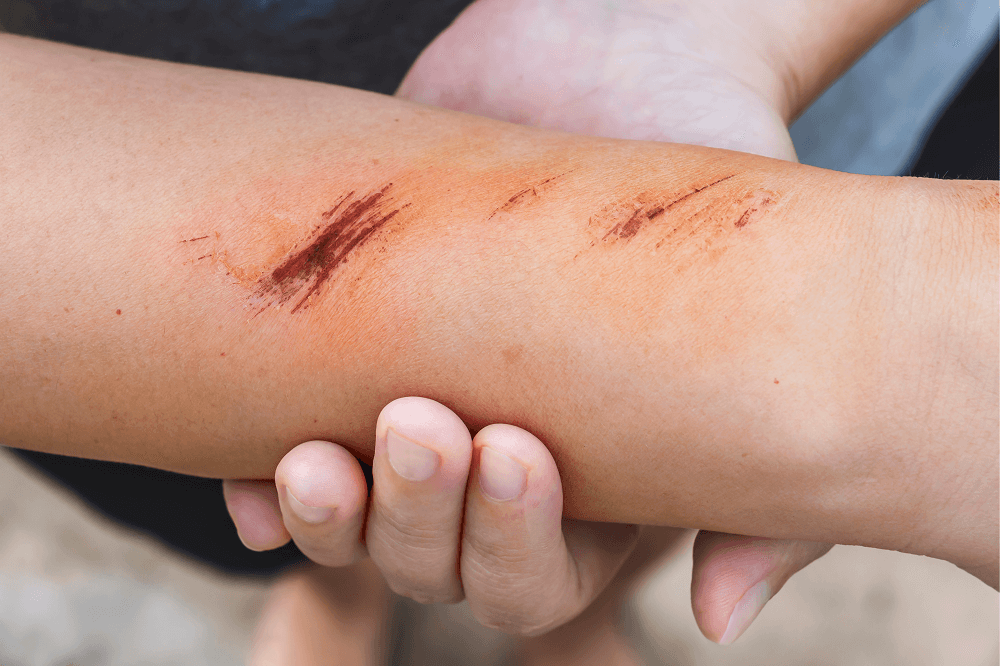 Specialized Wound Care